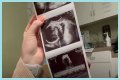 Counting On Alum Joy-Anna Forsyth Updates At 33 Weeks Pregnant