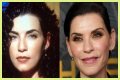 Julianna Margulies Doesn’t Look Natural After Plastic Surgery!
